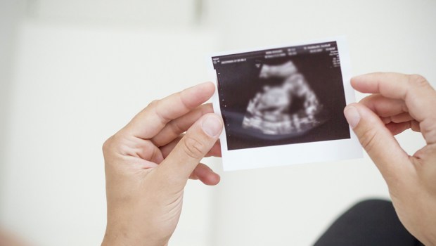 ULTRASOUND