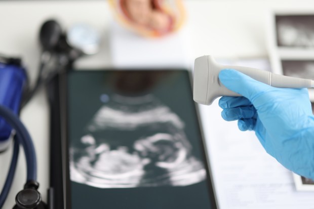 aborto